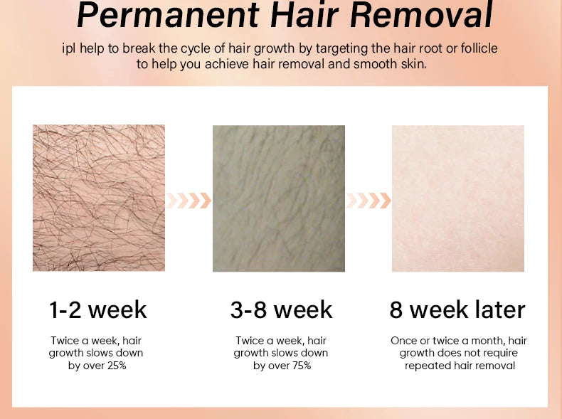 Gracefully Glowing 4-in-1 Ice IPL Hair Removal & Skin Rejuvenation Device