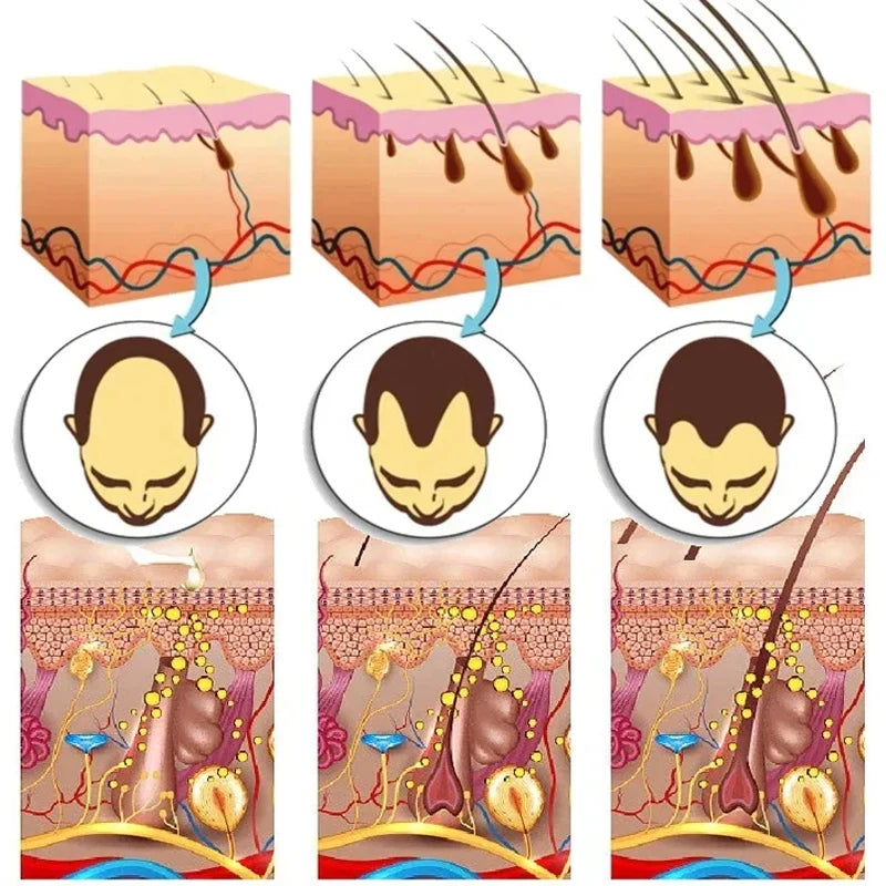 Gracefully Glowing™ Ginger Root Hair Growth Serum – Scalp Nourishing Anti-Hair Loss Treatment (30ml)
