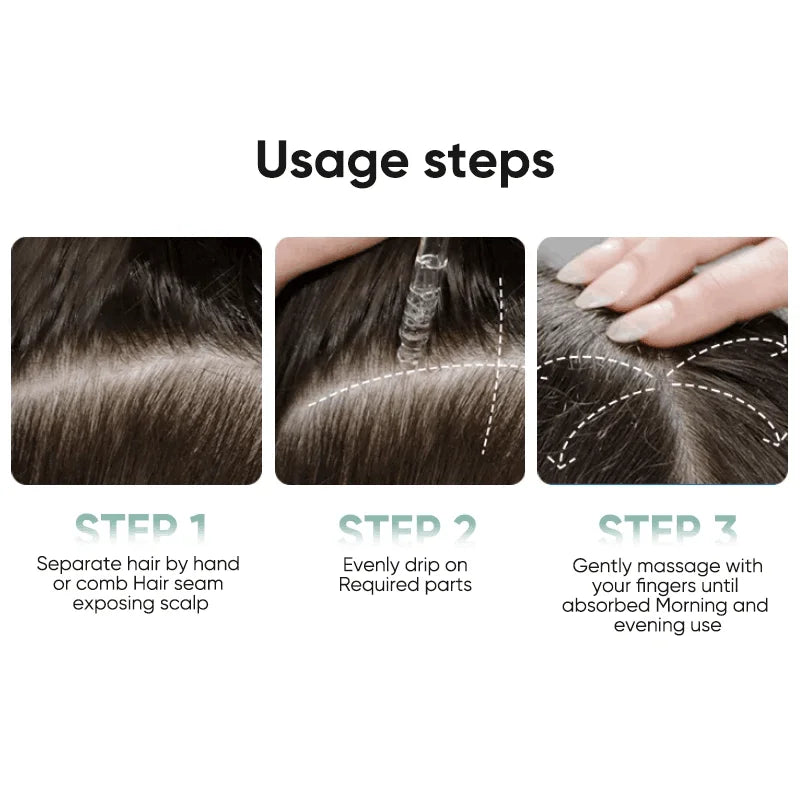 Gracefully Glowing™ Ginger Root Hair Growth Serum – Scalp Nourishing Anti-Hair Loss Treatment (30ml)