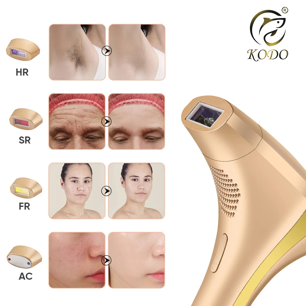 Gracefully Glowing 4-in-1 Ice IPL Hair Removal & Skin Rejuvenation Device